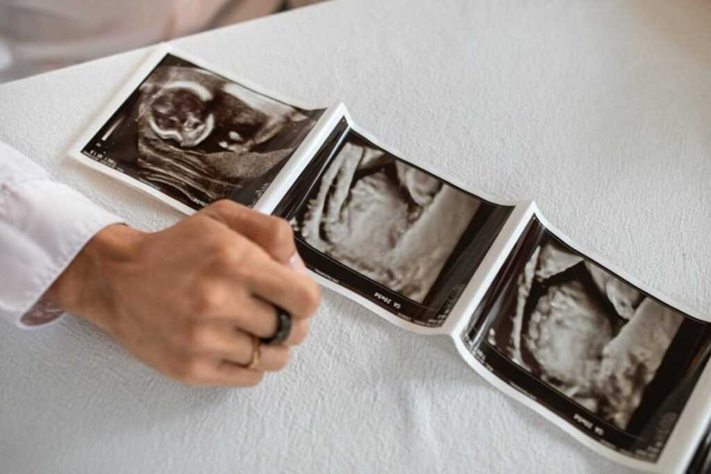 what is komatelate in pregnancy